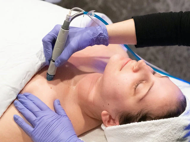 HYDRA FACIAL